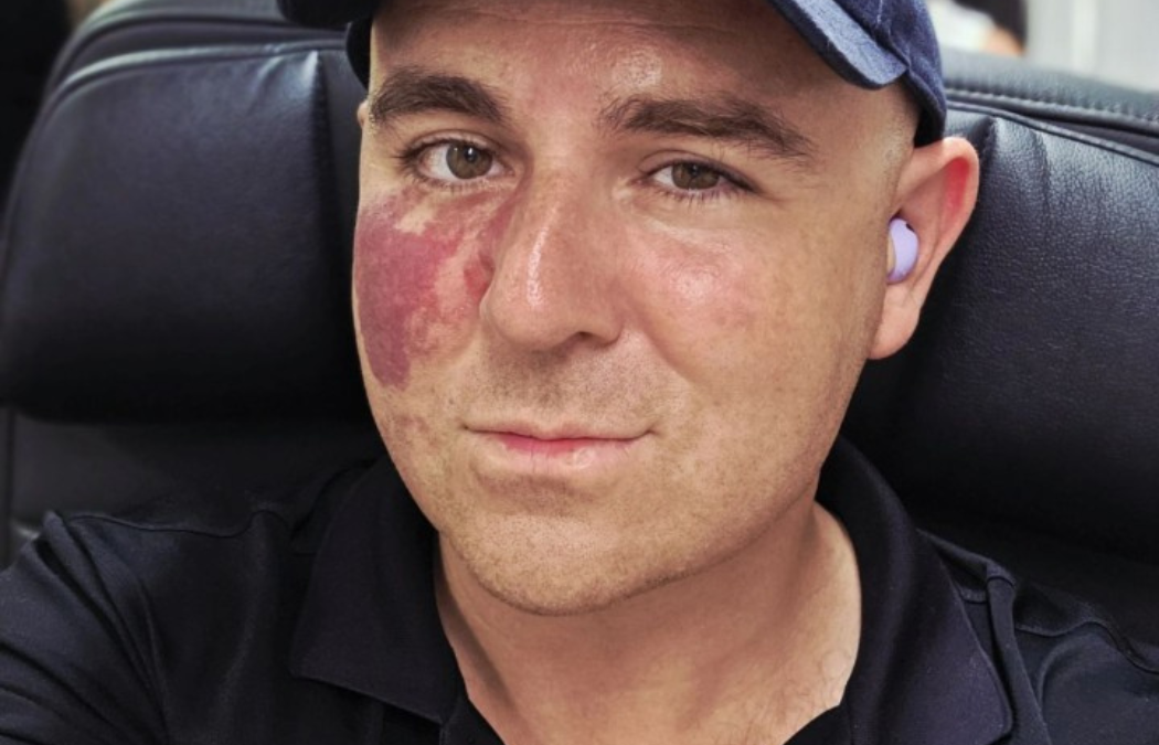 Edward Zia: From Fit to Flab and Back